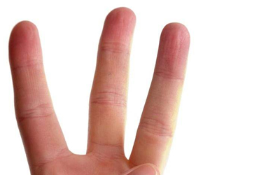玩手机游戏食指中指起茧_食指中指之间长茧_食指和中指之间有老茧怎么办