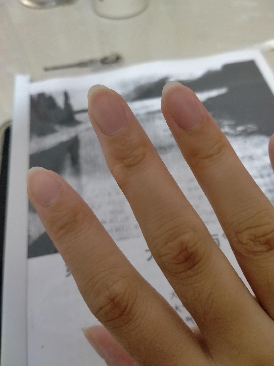 玩手机游戏食指中指起茧_食指和中指之间有老茧怎么办_食指中指之间长茧