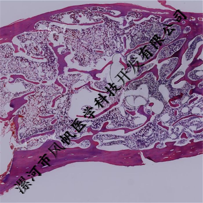 寄生虫epg_寄生虫原版_寄生虫中文