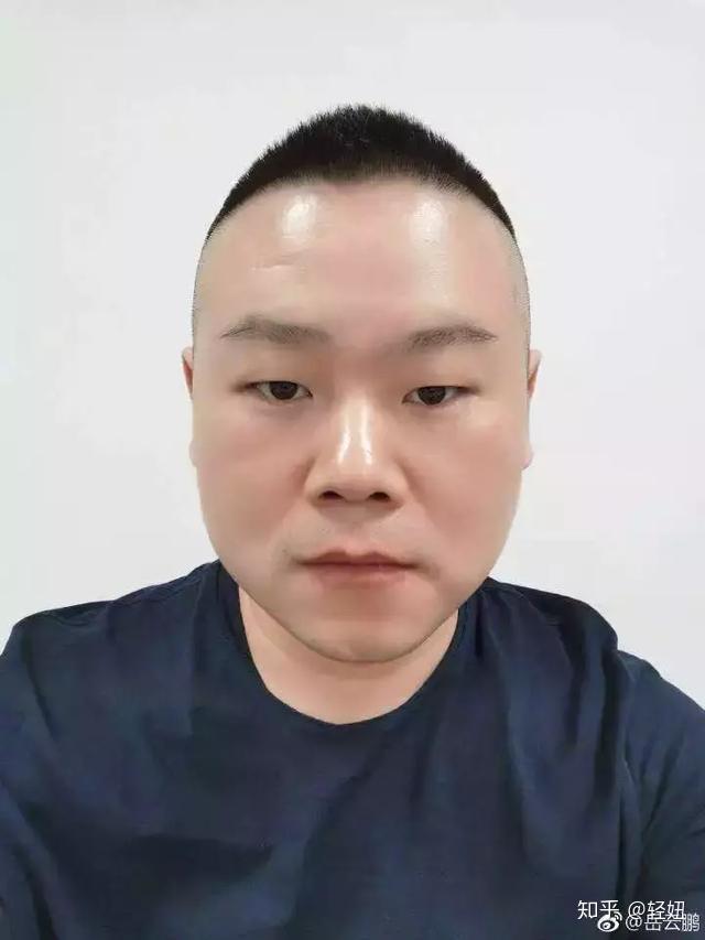 眼珠久变黑玩手机游戏能恢复吗_玩手机眼睛黑_玩手机游戏久黑眼珠变小