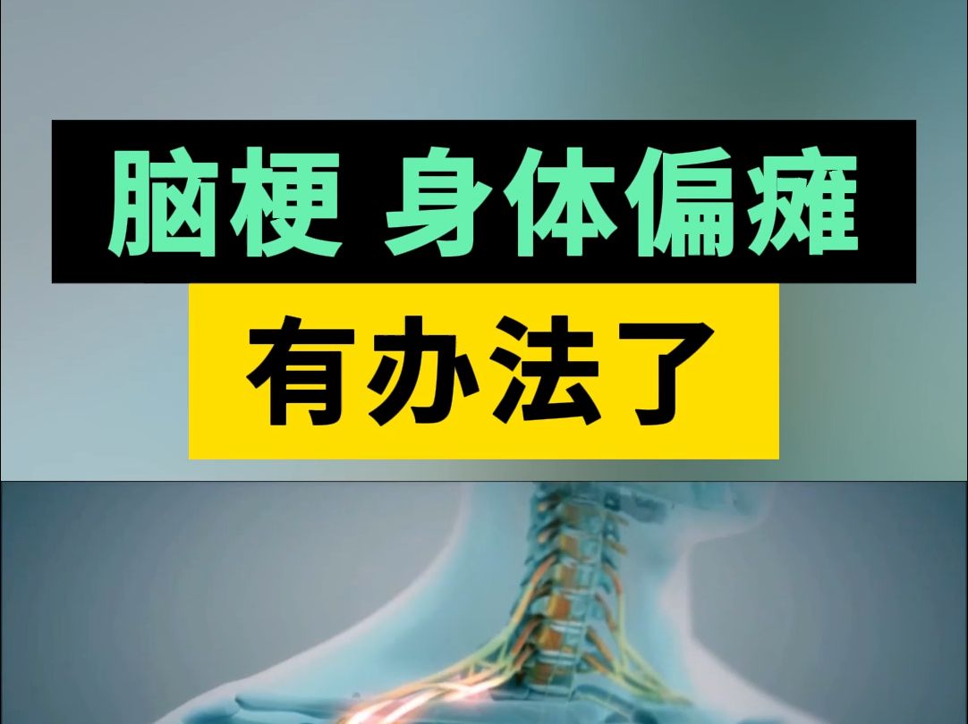 适合偏瘫患者的游戏_原因玩导致偏瘫手机游戏怎么办_玩手机游戏导致偏瘫的原因