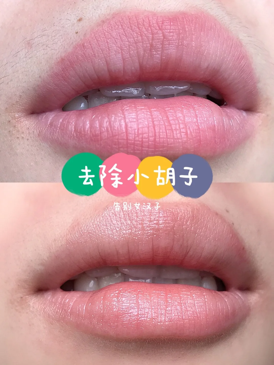 iphone怎么去掉下面横条_去掉苹果下面横条怎么设置_苹果下面的横条怎么去掉