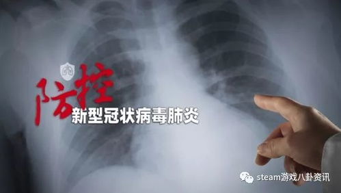 新型肺炎游戏,新型肺炎游戏深度体验解析(图3)