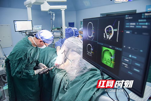 脑科手术游戏,探索脑科手术游戏的医学教育与娱乐融合(图3) 脑科手术游戏,探索脑科手术游戏的医学教育与娱乐融合(图3)