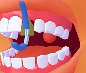 游戏牙科医生,体验牙科治疗乐趣与知识(图3) 游戏牙科医生,体验牙科治疗乐趣与知识(图3)
