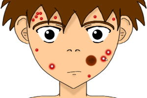 青春痘游戏,趣味游戏中的青春期健康知识之旅”(图3) 青春痘游戏,趣味游戏中的青春期健康知识之旅”(图3)