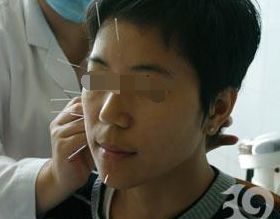 治面瘫的游戏,趣味游戏助力轻松恢复(图1)