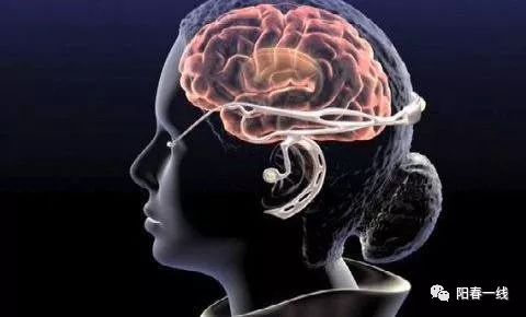 游戏时大脑,探索思维与反应的极限(图2) 游戏时大脑,探索思维与反应的极限(图2)