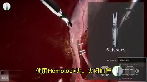 胆囊游戏,探索神秘胆囊世界的奇幻冒险之旅(图3)