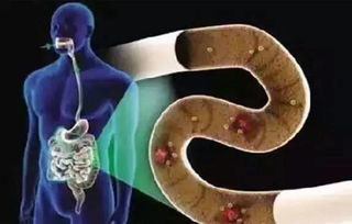 直肠扩张游戏,揭秘直肠扩张游戏的趣味与益处(图2) 直肠扩张游戏,揭秘直肠扩张游戏的趣味与益处(图2)
