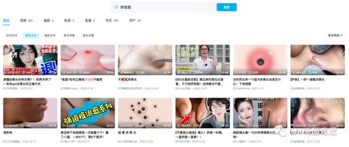 拔痘痘游戏,揭秘拔痘痘游戏的趣味与挑战(图2) 拔痘痘游戏,揭秘拔痘痘游戏的趣味与挑战(图2)