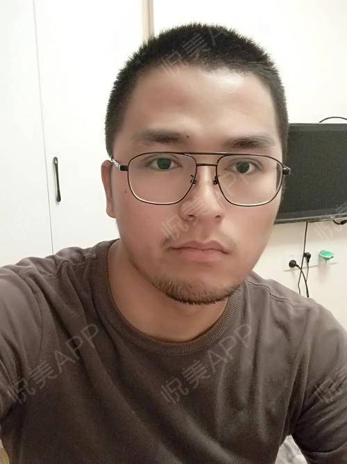 打完游戏眼睛,揭秘打完游戏眼睛的奇妙变化(图1) 打完游戏眼睛,揭秘打完游戏眼睛的奇妙变化(图1)