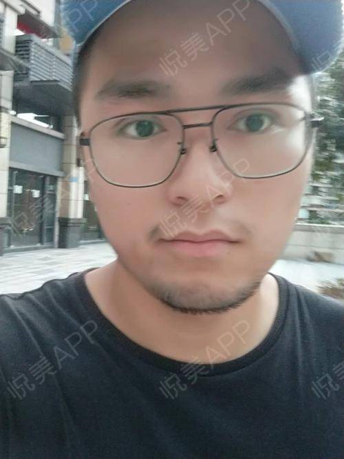 打完游戏眼睛,揭秘打完游戏眼睛的奇妙变化(图3) 打完游戏眼睛,揭秘打完游戏眼睛的奇妙变化(图3)