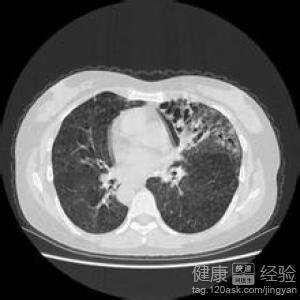 窦炎游戏,探索耳鼻喉健康新体验(图1) 窦炎游戏,探索耳鼻喉健康新体验(图1)