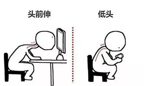 玩游戏肩膀痛,肩部疼痛揭示健康隐患(图1) 玩游戏肩膀痛,肩部疼痛揭示健康隐患(图1)