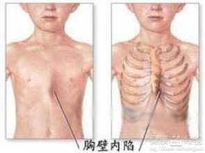 心肺类游戏,探索高效心肺类游戏体验(图1) 心肺类游戏,探索高效心肺类游戏体验(图1)