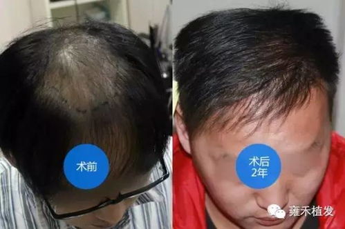 小游戏植发,探索绿色奇迹的奇幻之旅(图3)